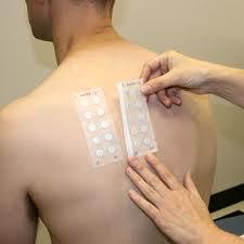 il patch test